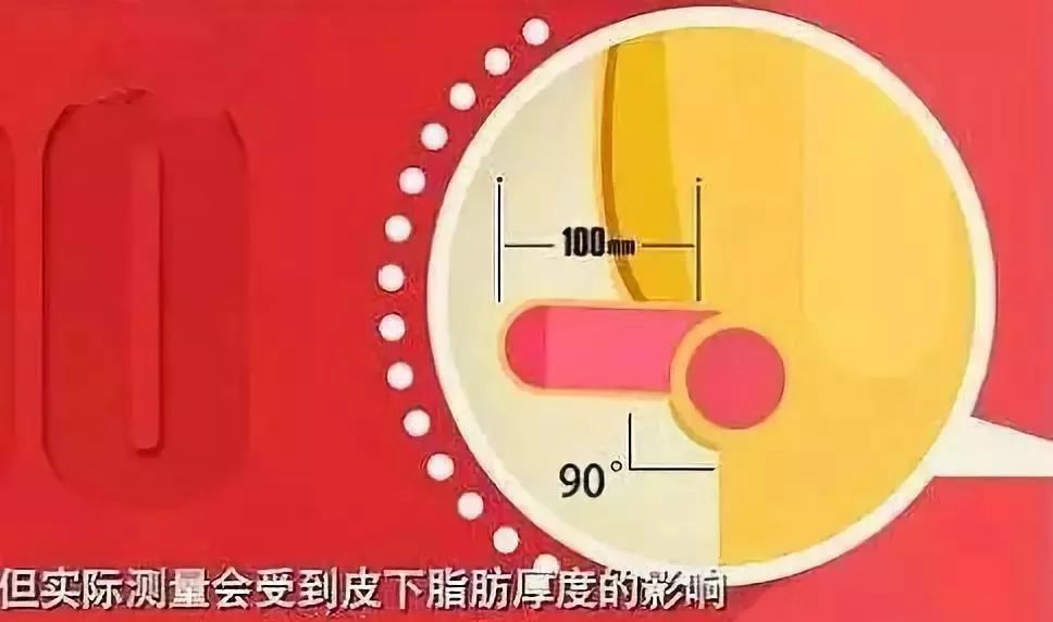 阴茎长度