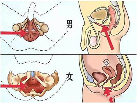 骨盆底肌（pc肌）